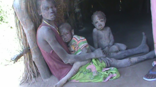 Nuba Mountains war crime victims